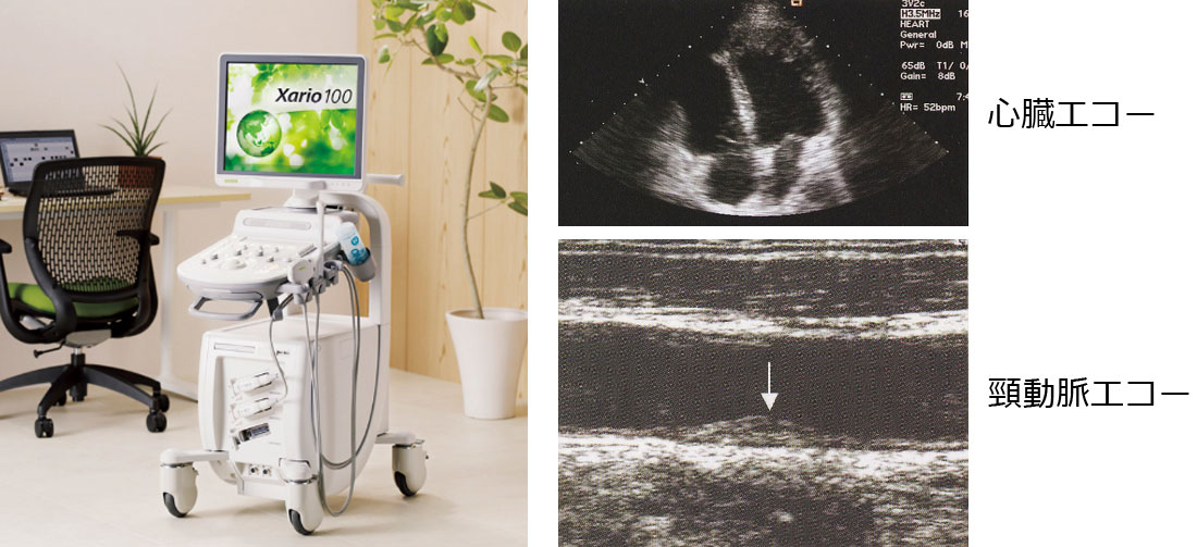 超音波（エコー）検査（心臓・腹部・頸動脈）