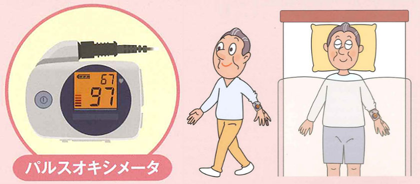 パルスオキシメトリー検査（経皮的動脈血酸素飽和度測定装置）