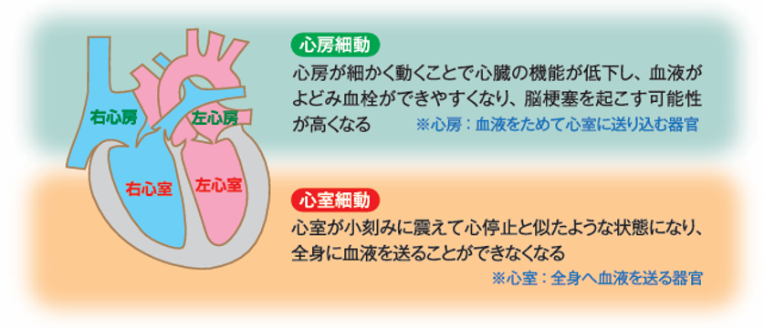 心房細動と心室細動