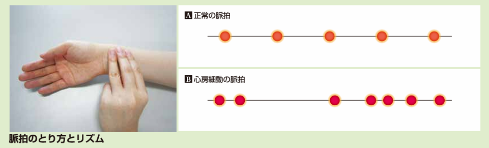 脈拍の取り方とリズム